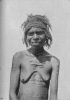Fig. 15. Young Woman, Arunta, showing body scars and tooth knocked out